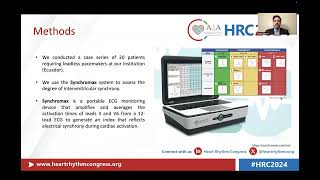 Synchronous Leadless Pacemaker High Score Abstract in HRC 2024 United Kingdom [upl. by Ayekam]