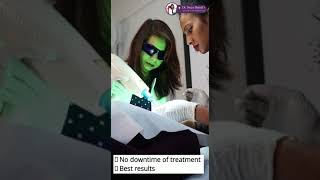 Freckles Treatment by Dermatologist  How to Get Rid of Freckles  Dr Naiya Bansal [upl. by Danny]