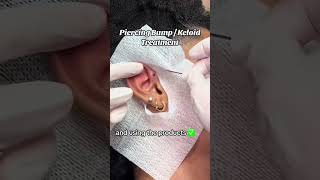 Struggling with piercing bumps Use Base Laboratories Piercing Bump Treatment for results 💕 [upl. by Nosyla]