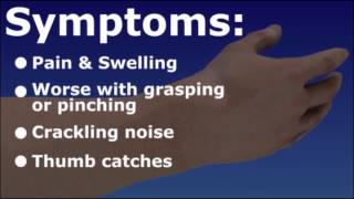 deQuervains Tendonitis  Wrist Tendonitis [upl. by Nadine]