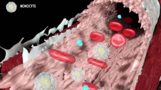 Development of atherosclerosis [upl. by Elsie217]