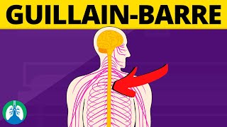 GuillainBarré Syndrome Medical Definition  Quick Explainer Video [upl. by Rojas949]