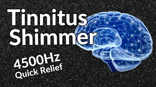 Tinnitus Shimmer  Sound Therapy Relief That WORKS [upl. by Oirretno]