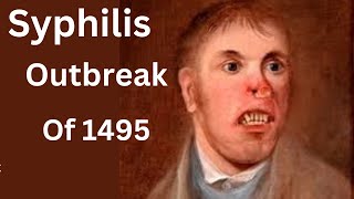 Europes 1495 Syphilis Outbreak The Untold Story [upl. by Aleb329]