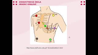 Elektrografická vyšetření [upl. by Barde270]