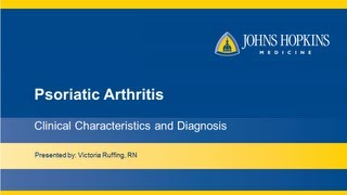 Psoriatic Arthritis  Clinical Characteristics and Diagnosis [upl. by Michale908]