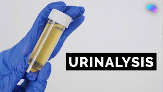 Urinalysis  Urine Dipstick Test  OSCE Guide  UKMLA  CPSA [upl. by Mall807]