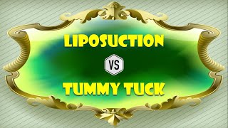 Liposuction versus Tummy tuck how to choose [upl. by Selfridge]