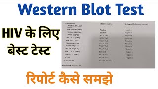 western blot test II Western blot report interpretation [upl. by Adner]