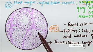 Histopathology of Renal Cell Carcinoma [upl. by Avat]