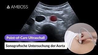 PointofCareUltraschall Teil 14 Sonografische Untersuchung der Aorta  AMBOSS [upl. by Alikam601]