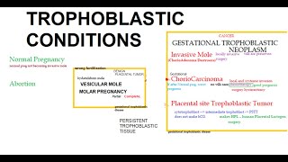 Pathology 750 Placenta Tumor Hydatidiform mole complete partial molar ChorioCarcinoma obstetrics [upl. by Charry]