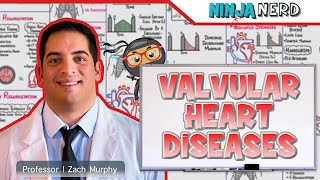 Valvular Heart Diseases  Clinical Medicine [upl. by Aimet434]