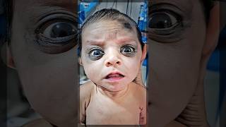 Big eyes 👁and chota baby And Nicu admit💝 trending today cute viral [upl. by Phio13]