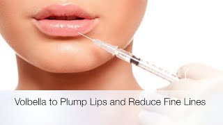 Volbella Lip Filler To Plump Hydrate and Smooth [upl. by Kleinstein]