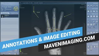 Rayence Part 2  Annotations amp Image Editing [upl. by Mcculloch]