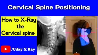 Cervical Spine Xray Positioning  AP amp Lateral View  Uday X Ray [upl. by Ynnattirb]