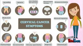 Endocervical Adenocarcinoma [upl. by Wakefield]