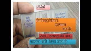 Hemocytometer manual a complete solution for RBCWBC and Platelet count practically based in Hindi [upl. by Rovaert]