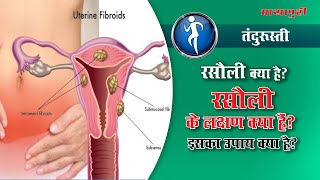 Uterine Fibroid Symptoms Precautions amp Treatment  Rasoli ka Ilaj in Hindi ft Dr Mangla Dogra [upl. by Jeanelle]