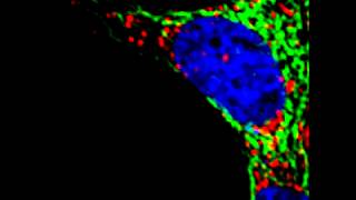 Mitochondrial and lysosomal dynamics [upl. by Alor547]