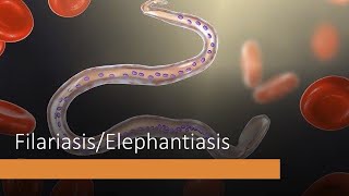 BIOLOGY Chapter 10 Human Diseases Filariasis Elephantiasis HSC New Syllabus [upl. by Harriette]