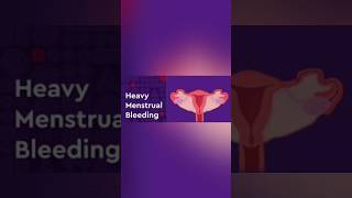 Heavy periods  menorrhagia [upl. by Alexandros]