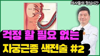 자궁근종 색전술의 모든 것 Part2  시술 전후 비교와 만족도 [upl. by Deloria]