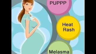 Rashes During Pregnancy [upl. by Maurice]