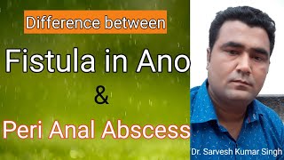 मल द्वार पर होने वाला घाव और भगंदर में अंतर  difference between Peri anal abscess amp Fistula in ano [upl. by Gettings]