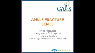 Ankle Fracture Series Management Technique for Trimalleolar Fractures  GAITS Academy [upl. by Jobey]