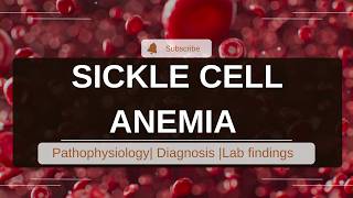 Sickle cell disease Pathophysiology clinical features diagnosis amp treatment Sickle cell anemia [upl. by Haraj]