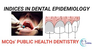 MCQs on Indices in Dental Epidemiology  Community Dentistry  Dentophile [upl. by Anthia162]