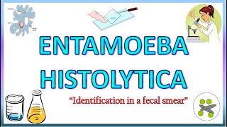 Entamoeba Histolytica  Morphology of the Trophozoite amp Cyst on Light Microscope Stools for AOC [upl. by Aiyram]