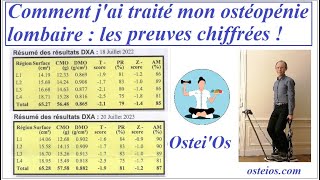 Témoignage  traitement naturel de lOstéoporose et lOstéopénie vertébrale [upl. by Eesdnyl953]