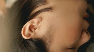 What is a perforated eardrum  Patient Explainers [upl. by Warthman]