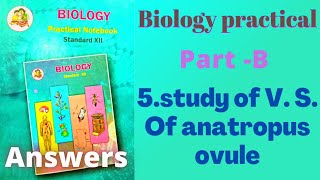 5study of V S Of anatropus ovule Biology practical class 12 practical 5 [upl. by Warms]