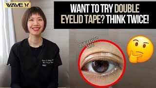 Transform Your Eyes Double Eyelid Tape vs Upper Blepharoplasty [upl. by Marlette]