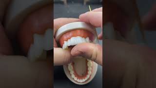 How teeth are designed hospital dentist teeth shortvideo shortsyoutube shorts [upl. by Torie473]