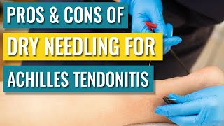 Dry Needling For Achilles Tendinopathy  Tendonitis — Does It Help [upl. by Solorac]