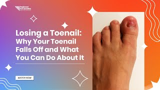 Losing a Toenail Why Your Toenail Falls Off and What You Can Do About It [upl. by Maryann]