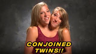 ALL YOU NEED TO KNOW About TLC Conjoined Twins Abby amp Brittany [upl. by Asuncion]