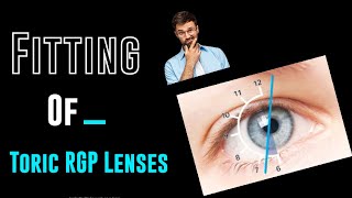 Fitting Of Toric RGP contact lensesfront back surfacebitoric and peripheral lens designoptometry [upl. by Rothberg]