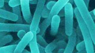 Update on foodborne listeria outbreaks [upl. by Yadahs]