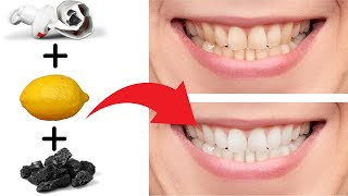 Prueba esta receta de blanqueamiento dental que sorprenderán a todos [upl. by Nnylav]