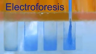 Electroforesis de Proteínas Divulgación científica IQOGCSIC [upl. by Demmahum]