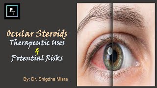 Ocular Steroids  Therapeutic Uses amp Potential Risks [upl. by Ailecra]