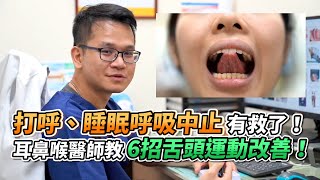 打呼、睡眠呼吸中止有救了！耳鼻喉醫師教6招舌頭運動改善！｜VS MEDIAｘ陳亮宇耳鼻喉科診所 [upl. by Koerner81]