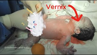 Do you know anything about the vernix layer of newborns [upl. by Abercromby]