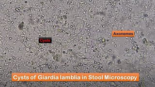 Stool Faeces Saline Wet Mount Preparation and Microscopy showing Giardia at various magnifications [upl. by Enoryt]